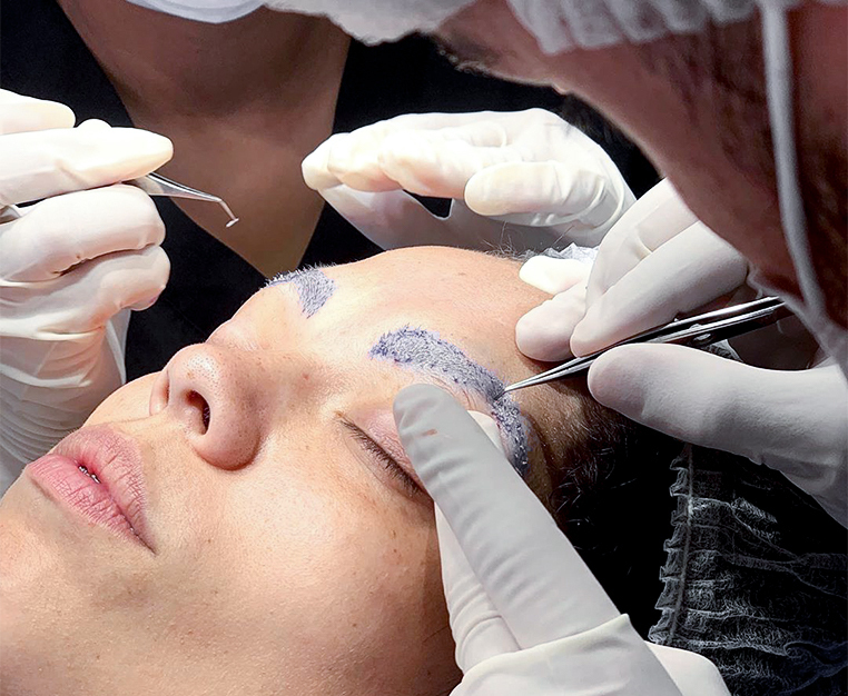Replacement Eyebrows Thinking About Getting an Eyebrow Transplant? Here's Everything You ...